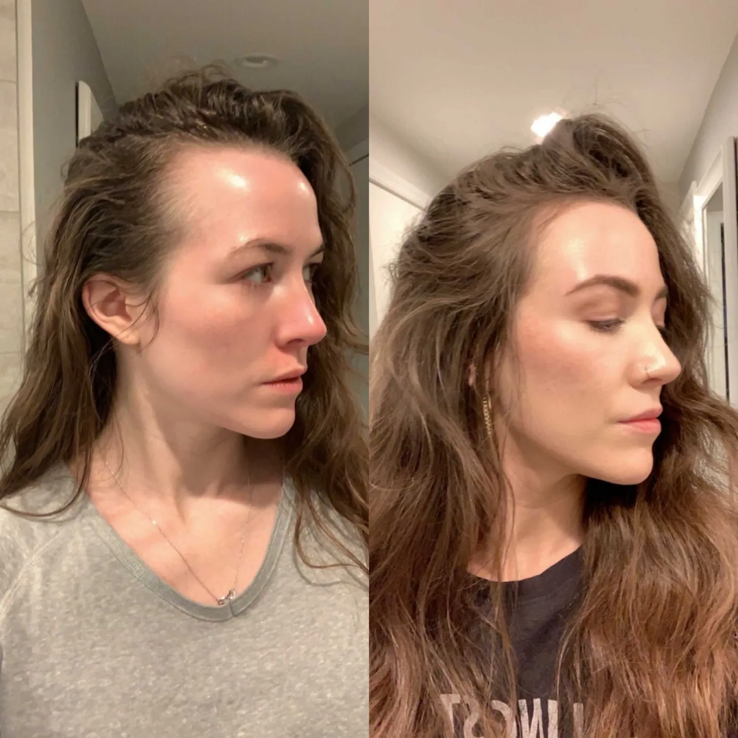 Vorher Nachher, Julia 34